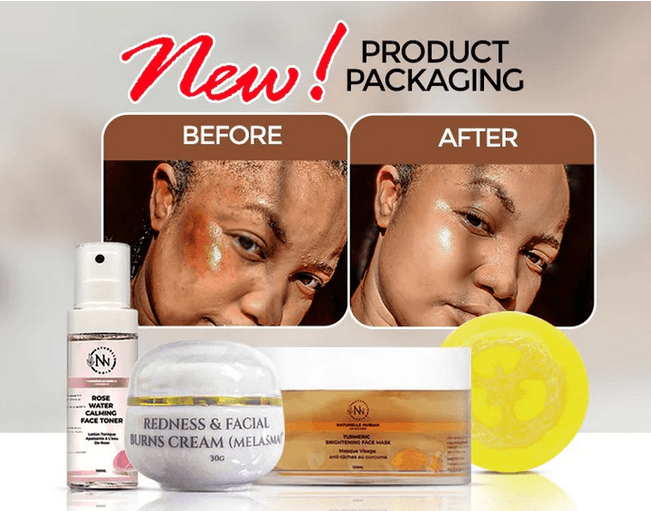 Kit Rougeurs et Brûlures (Parfait pour le mélasma) - Image 1