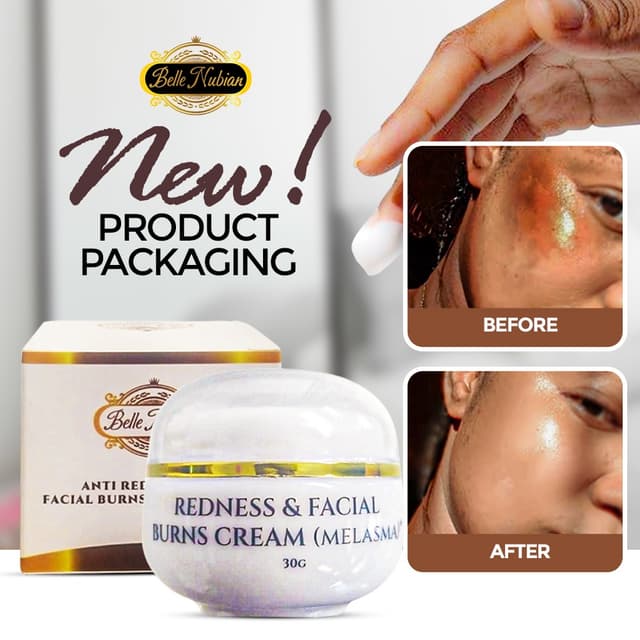 Crème Anti- Rougeurs et Brûlures Du Visage (mélasma)