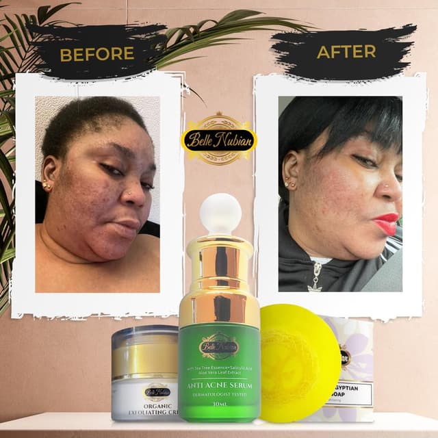kit anti tache